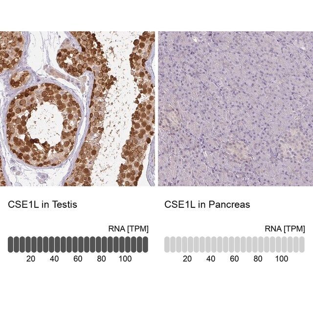 Anti-CSE1L antibody produced in rabbit