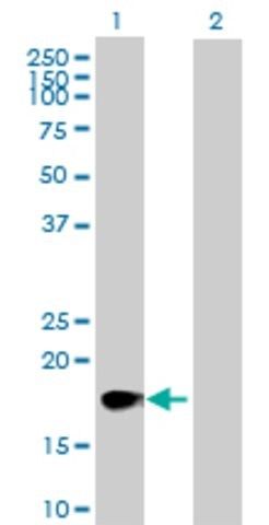 Anti-CSF2 antibody produced in rabbit