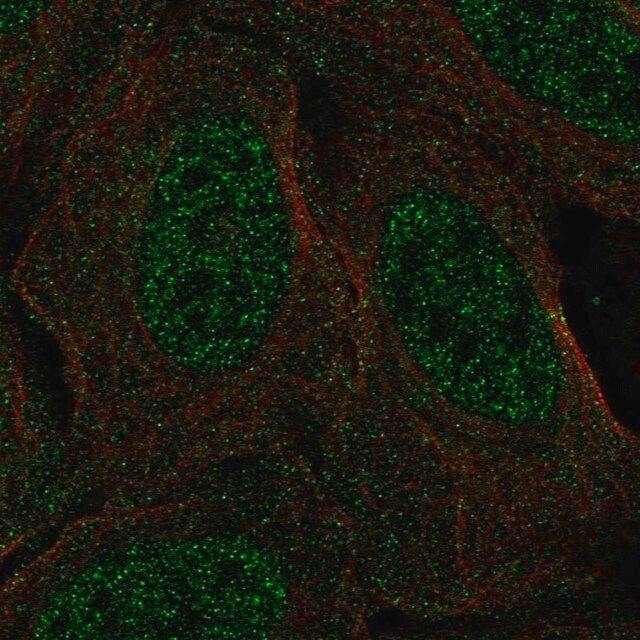 Anti-CSDC2 antibody produced in rabbit