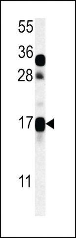 ANTI-CSAG2(N-TERMINAL) antibody produced in rabbit