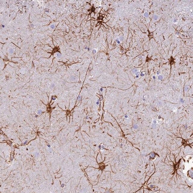 Anti-C17orf67 antibody produced in rabbit