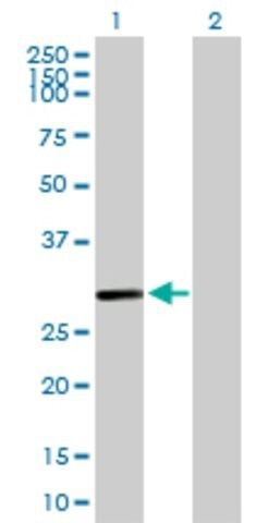 Anti-C10ORF63 antibody produced in mouse