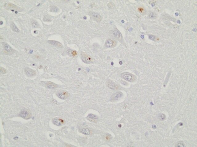 Anti-C9ORF72/C9RANT (poly-GR) Antibody, clone 5A2