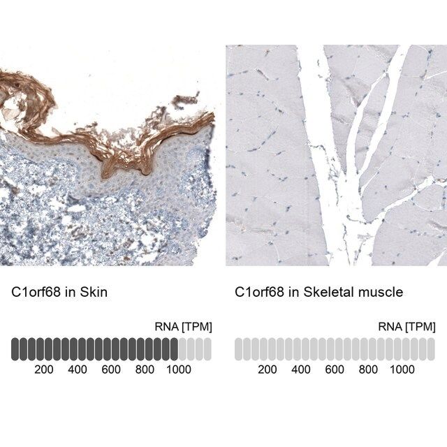 Anti-C1orf68 antibody produced in rabbit