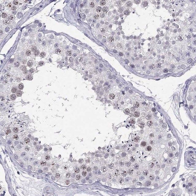 Anti-C11orf63 antibody produced in rabbit