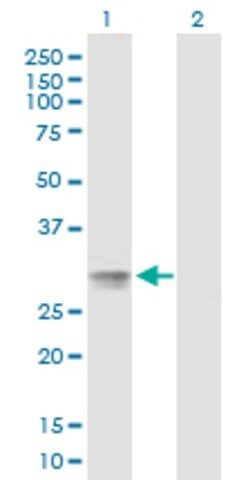 Anti-C20orf70 antibody produced in mouse