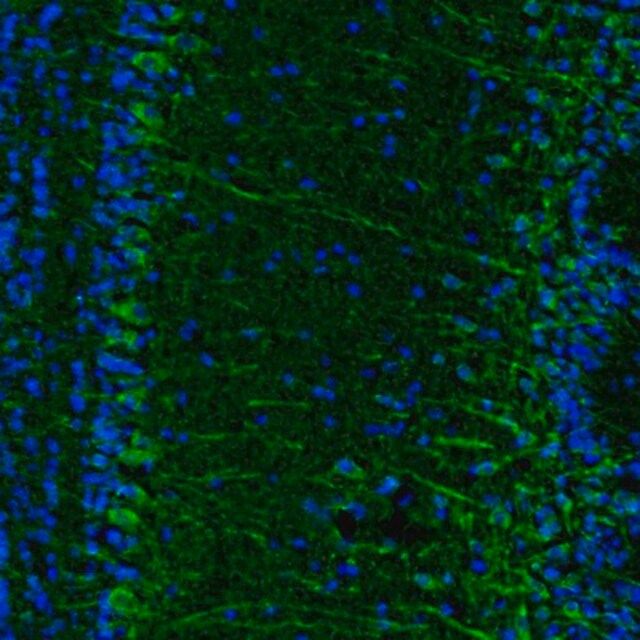 Anti-C17orf75 antibody produced in rabbit