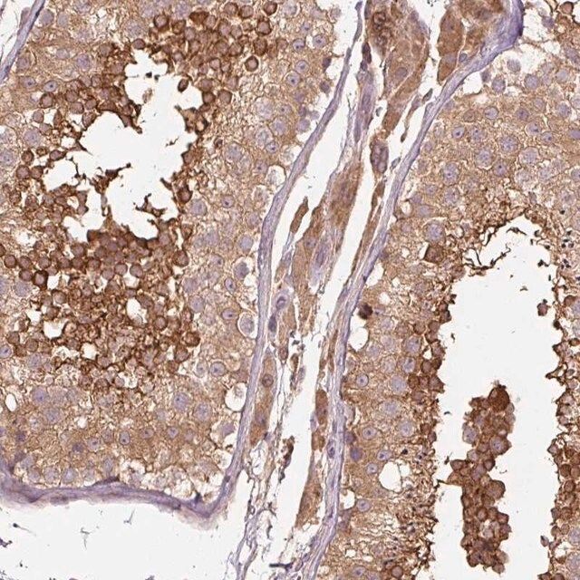 Anti-C2orf73 antibody produced in rabbit