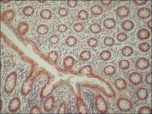 Anti-C9orf72 antibody produced in rabbit