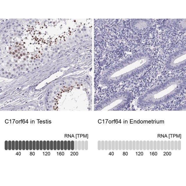 Anti-C17orf64 antibody produced in rabbit