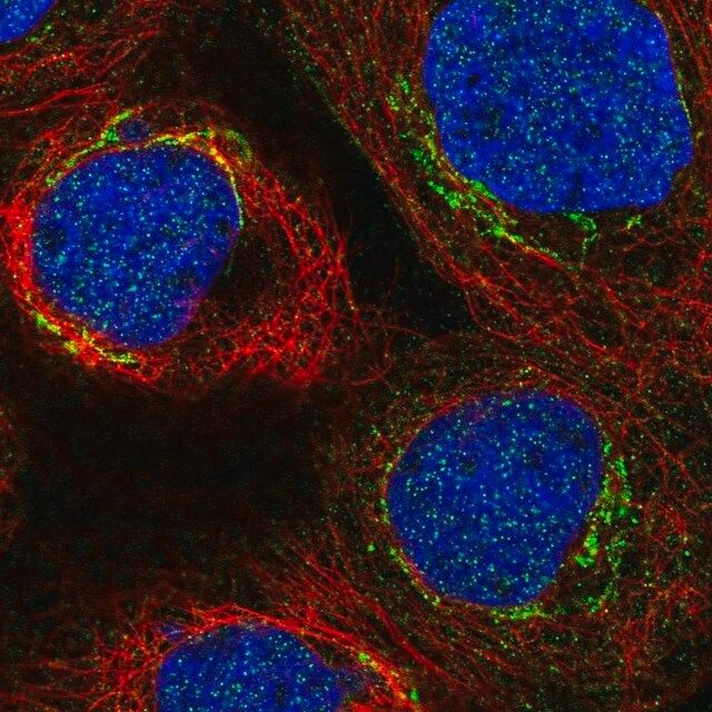 Anti-C3orf67 antibody produced in rabbit