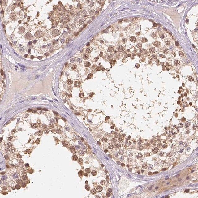 Anti-C10orf67 antibody produced in rabbit