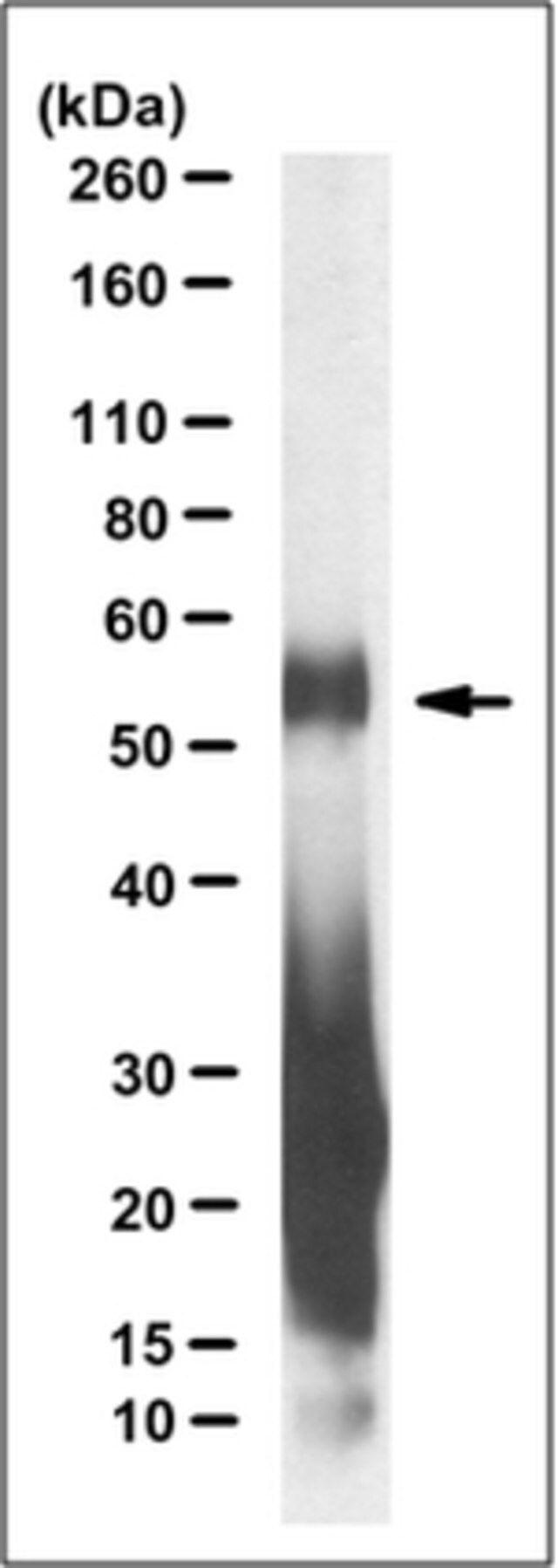 Anti-C9ORF72/C9RANT (poly-GA) Antibody, clone 5E9