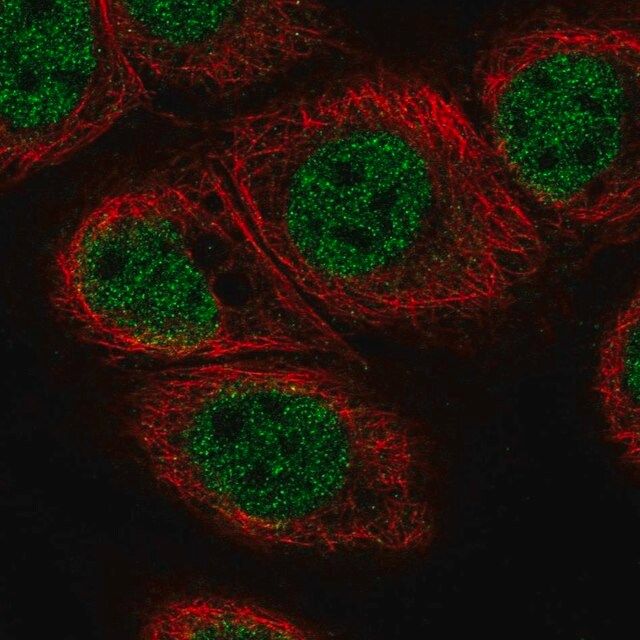 Anti-C11orf71 antibody produced in rabbit