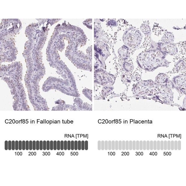 Anti-C20orf85 antibody produced in rabbit