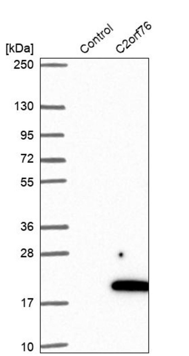 Anti-C2orf76 antibody produced in rabbit