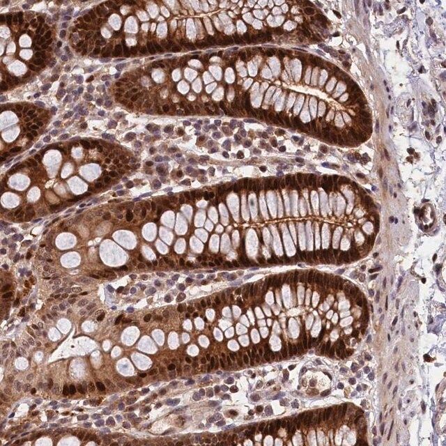 Anti-C16orf70 antibody produced in rabbit