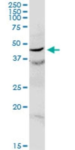 Anti-C17orf75 antibody produced in rabbit