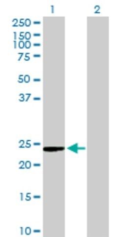 Anti-C9ORF95 antibody produced in mouse