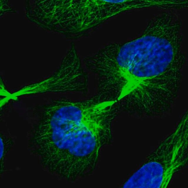 Anti-C21orf91 antibody produced in rabbit