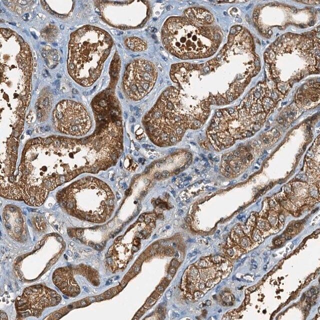 Anti-C10orf90 antibody produced in rabbit