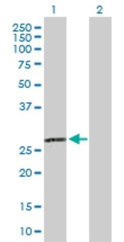 Anti-C1QA antibody produced in rabbit