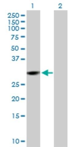 Anti-CMBL antibody produced in mouse