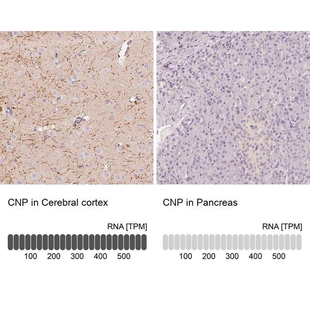 Anti-CNP antibody produced in rabbit