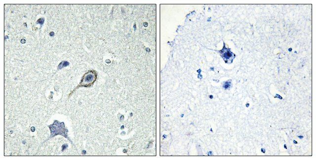 Anti-CNR1 antibody produced in rabbit