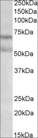 Anti-CNR1 antibody produced in goat