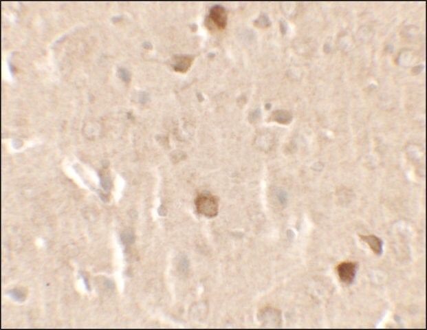 Anti-CNRIP1 antibody produced in rabbit