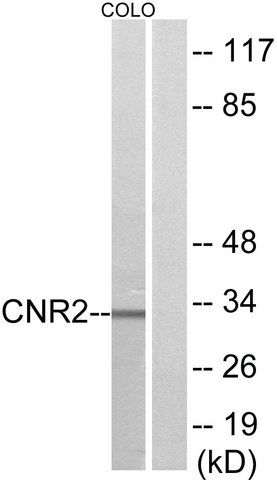 Anti-CNR2 antibody produced in rabbit