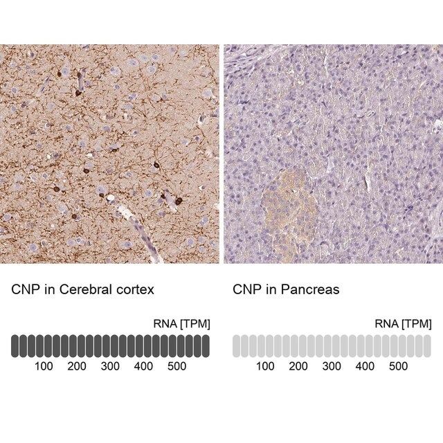 Anti-CNP antibody produced in rabbit