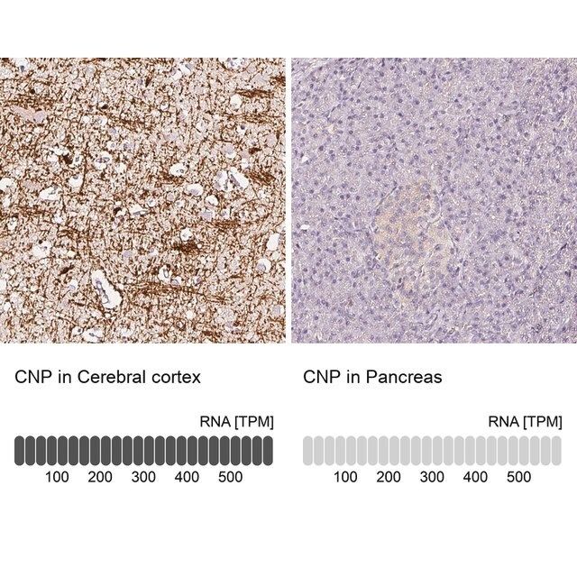 Anti-CNP antibody produced in rabbit