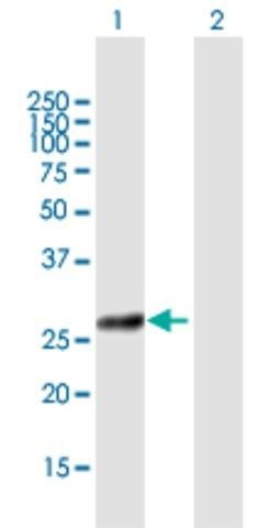 Anti-COG8 antibody produced in mouse