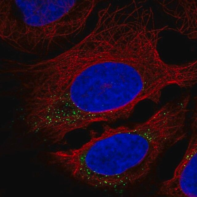 Anti-CNST antibody produced in rabbit