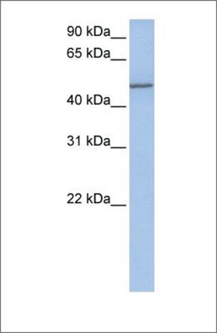 Anti-COL25A1 antibody produced in rabbit