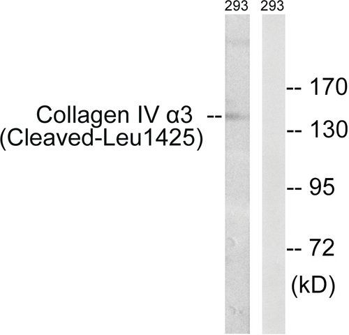 Anti-Collagen IV 3 (Cleaved-Leu<sup>1425</sup>) antibody produced in rabbit