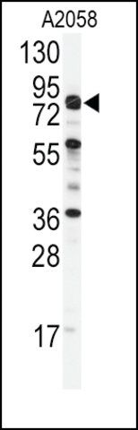 Anti-COG4 (C-term) antibody produced in rabbit