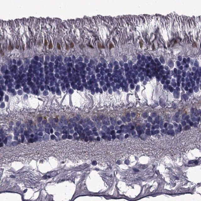 Anti-COL9A1 antibody produced in rabbit