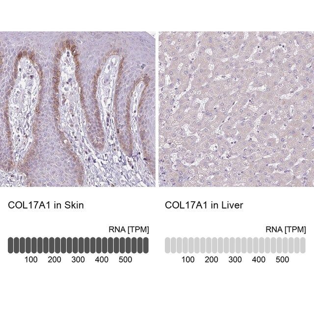 Anti-COL17A1 antibody produced in rabbit