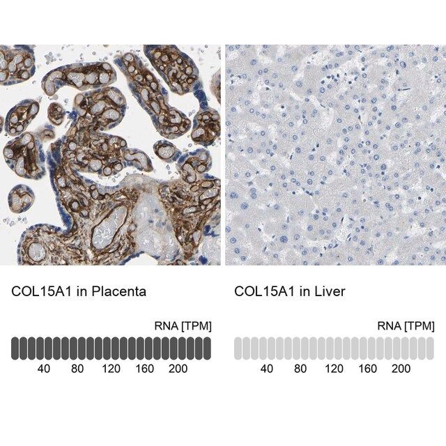 Anti-COL15A1 antibody produced in rabbit