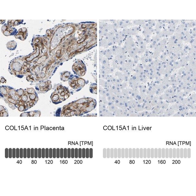 Anti-COL15A1 antibody produced in rabbit