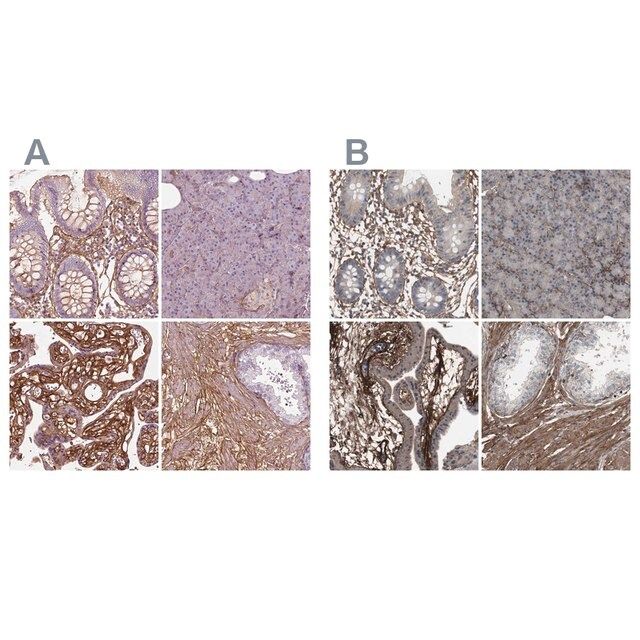 Anti-COL6A2 antibody produced in rabbit