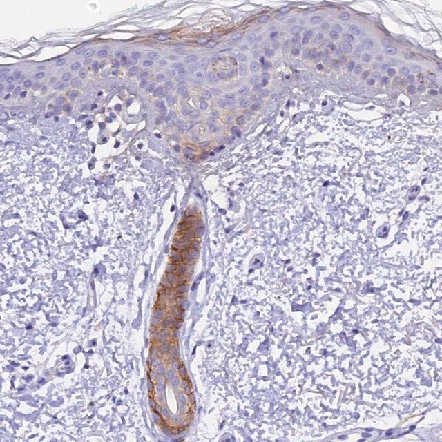 Anti-COL6A5 antibody produced in rabbit