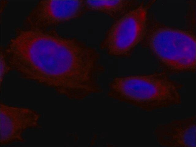 Anti-Collagen, Type X antibody, Mouse monoclonal