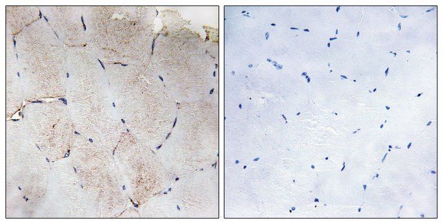 Anti-Collagen XII 1 antibody produced in rabbit