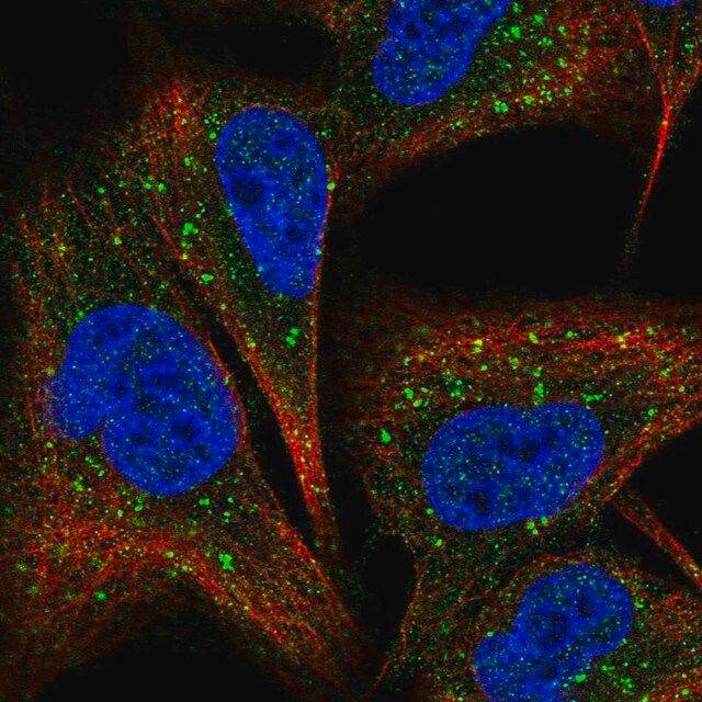 Anti-COMMD7 antibody produced in rabbit