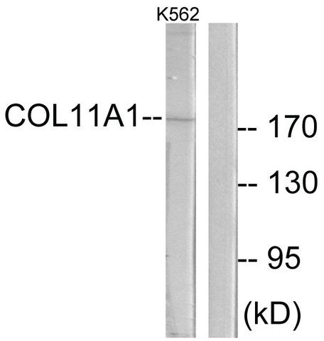 Anti-Collagen XI 1 antibody produced in rabbit