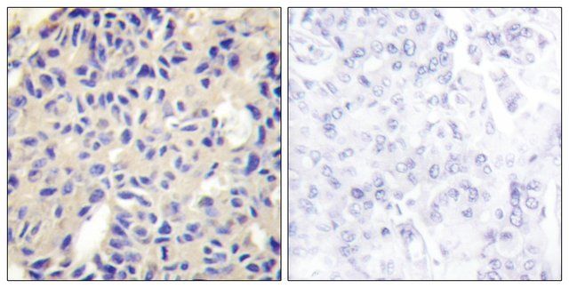 Anti-Collagen V 2 antibody produced in rabbit